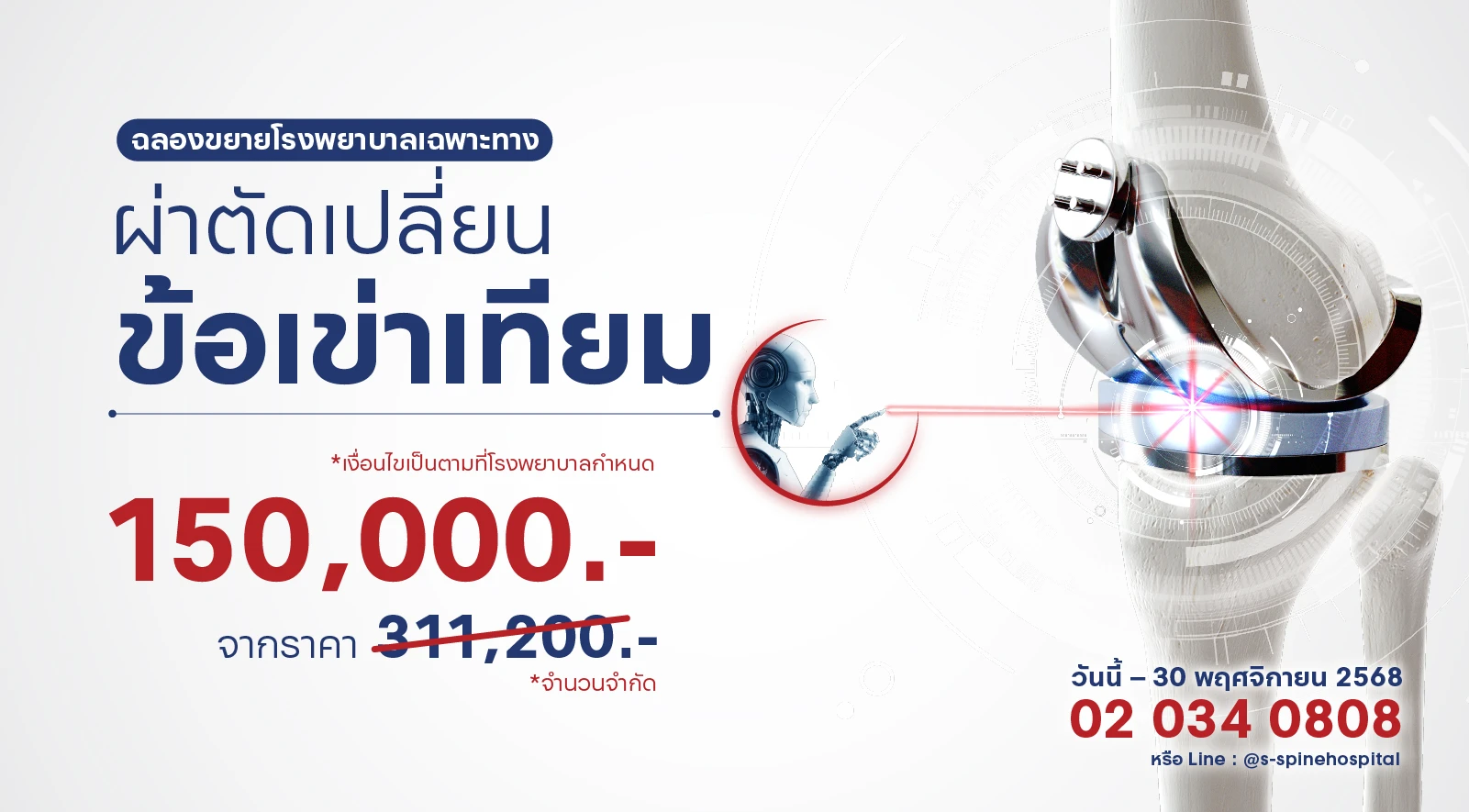 โปรโมชั่นแห่งปี! ความคุ้มค่าที่คุณไม่ควรพลาด ผ่าตัดเปลี่ยนข้อเข่าเทียม ราคาเพียง 150,000 บาท 