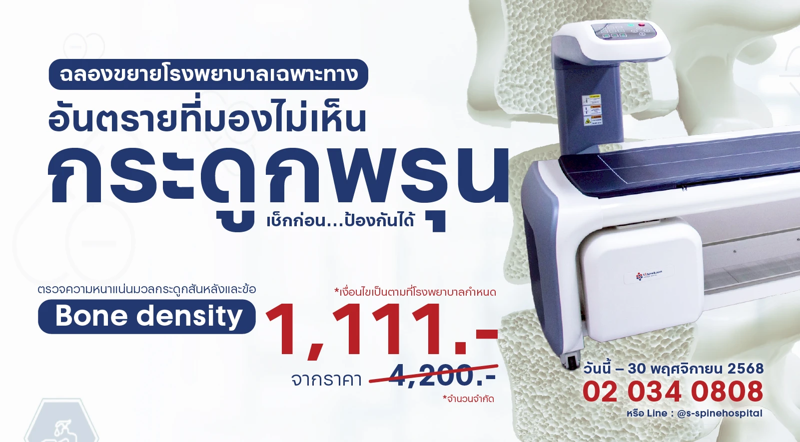 โปรโมชั่นพิเศษ! ตรวจ Bone Density เพียง 1,111 บาท  ที่ โรงพยาบาลเฉพาะทางด้านกระดูกสันหลังและข้อ เอส สไปน์ แอนด์ จอยท์  เรากล้าให้คุณได้มากกว่าใคร 