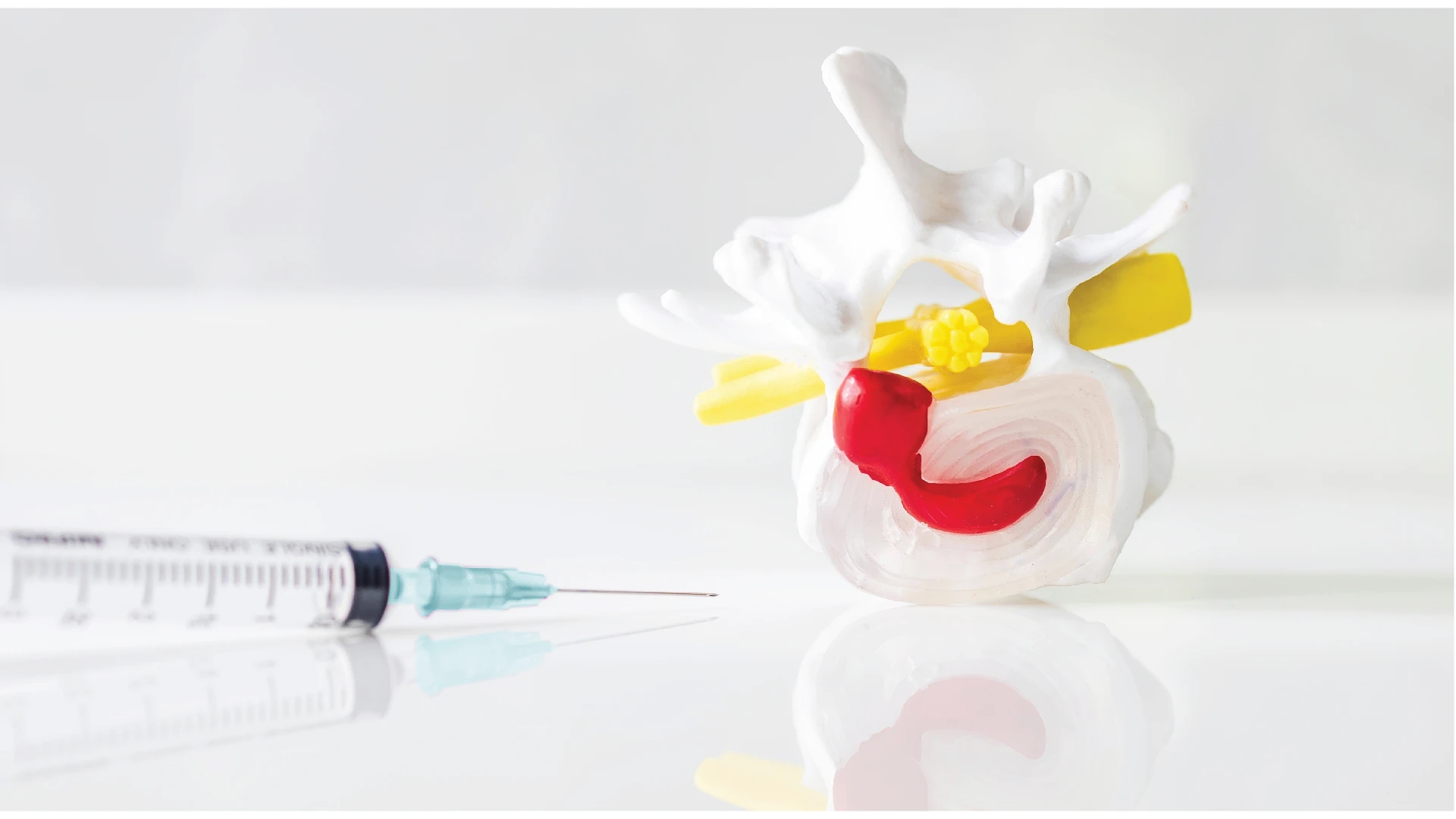 Nerve Root Block Injection (SNRB) 