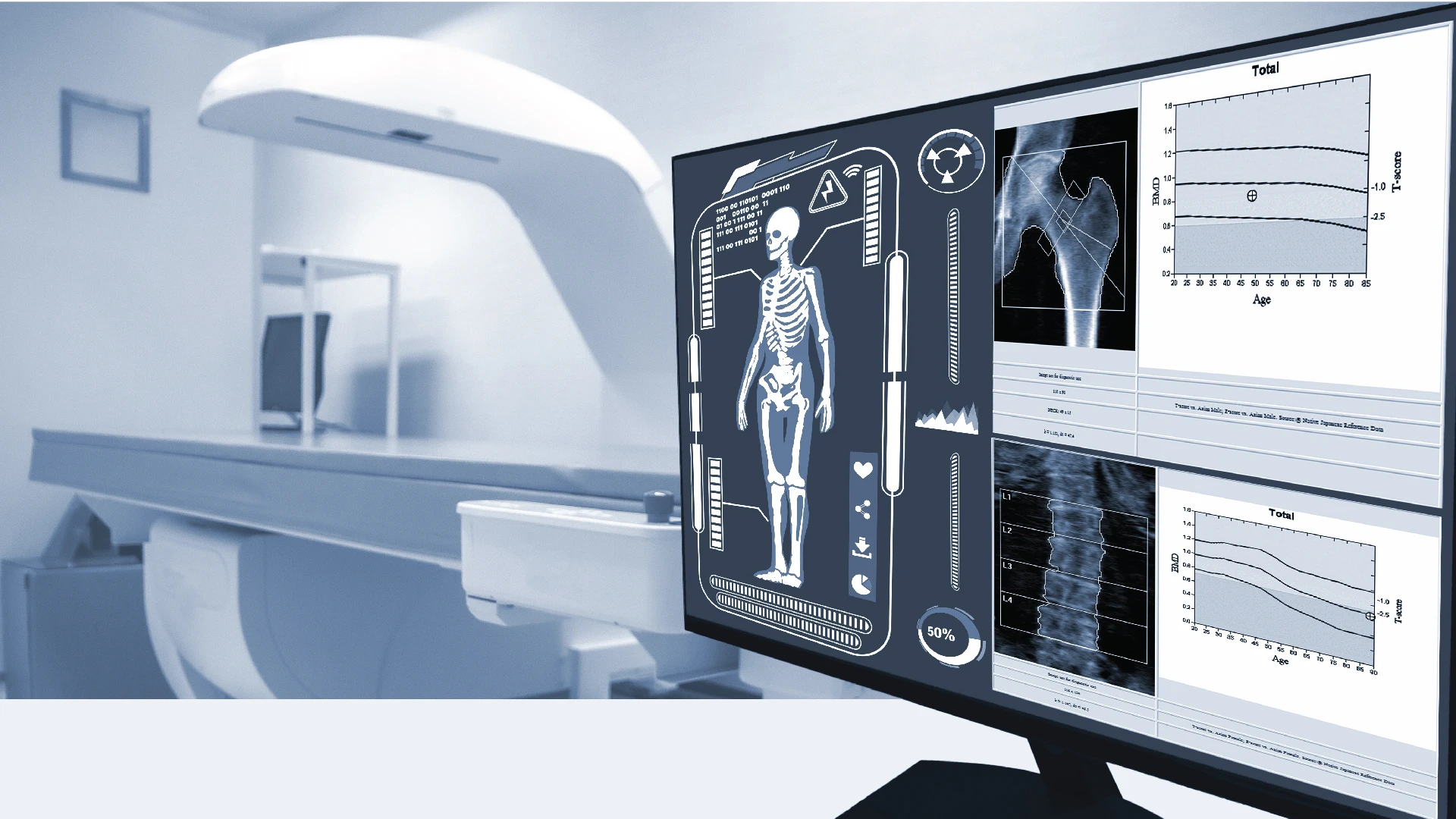 Bone Mineral Density (BMD)  