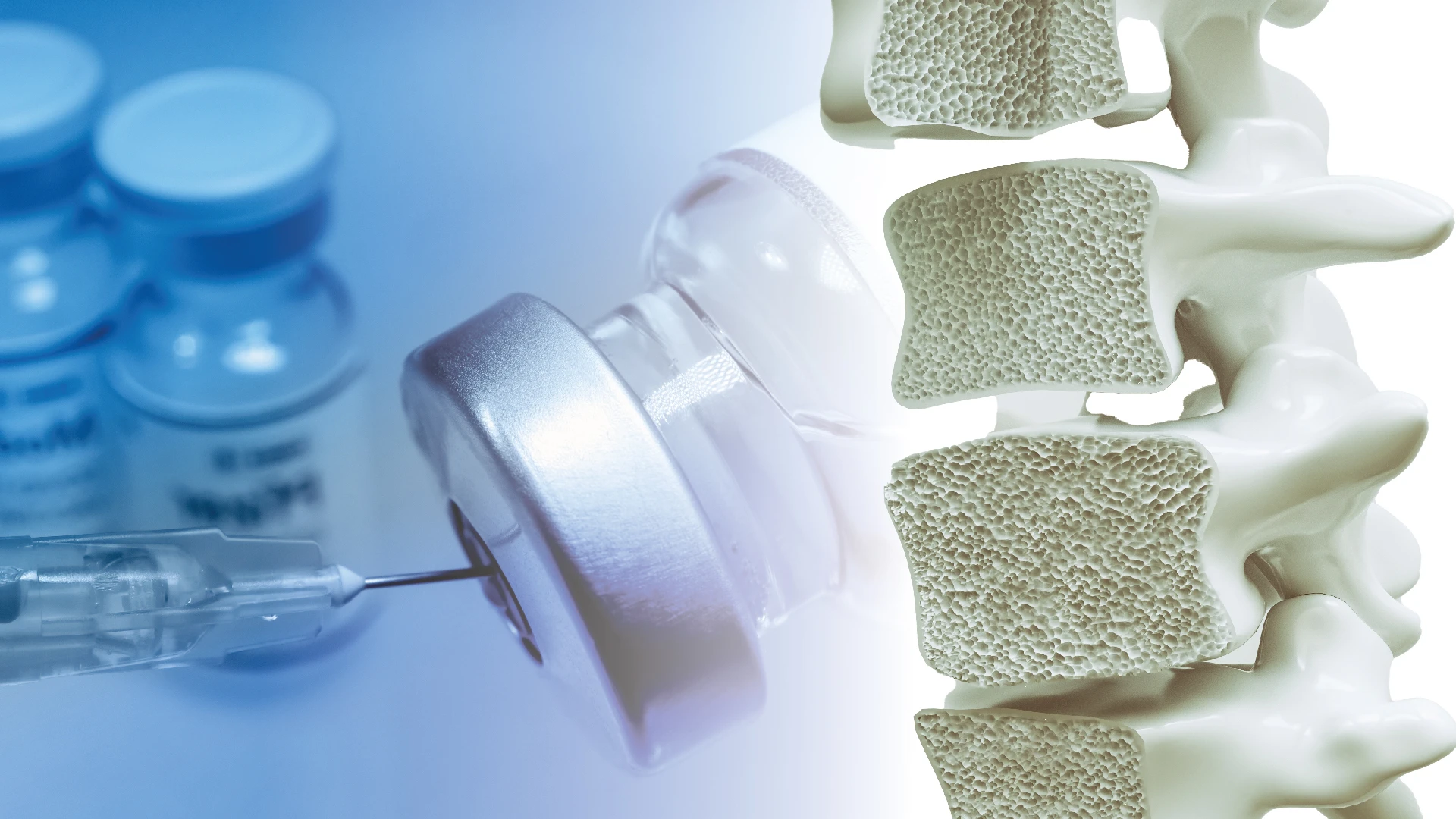 Reducing Bone Resorption