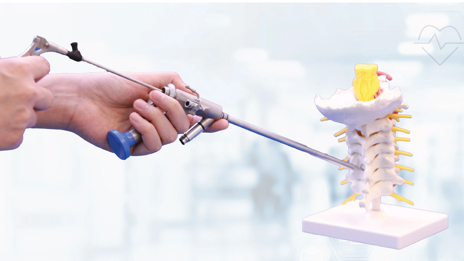 Posterior Cervical Endoscopic Discectomy (PSCD) 
